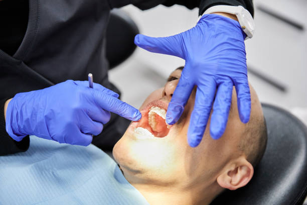 Best Emergency Wisdom Teeth Removal in Palm Springs, CA