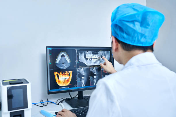 Best Emergency Tooth Extraction in Palm Springs, CA